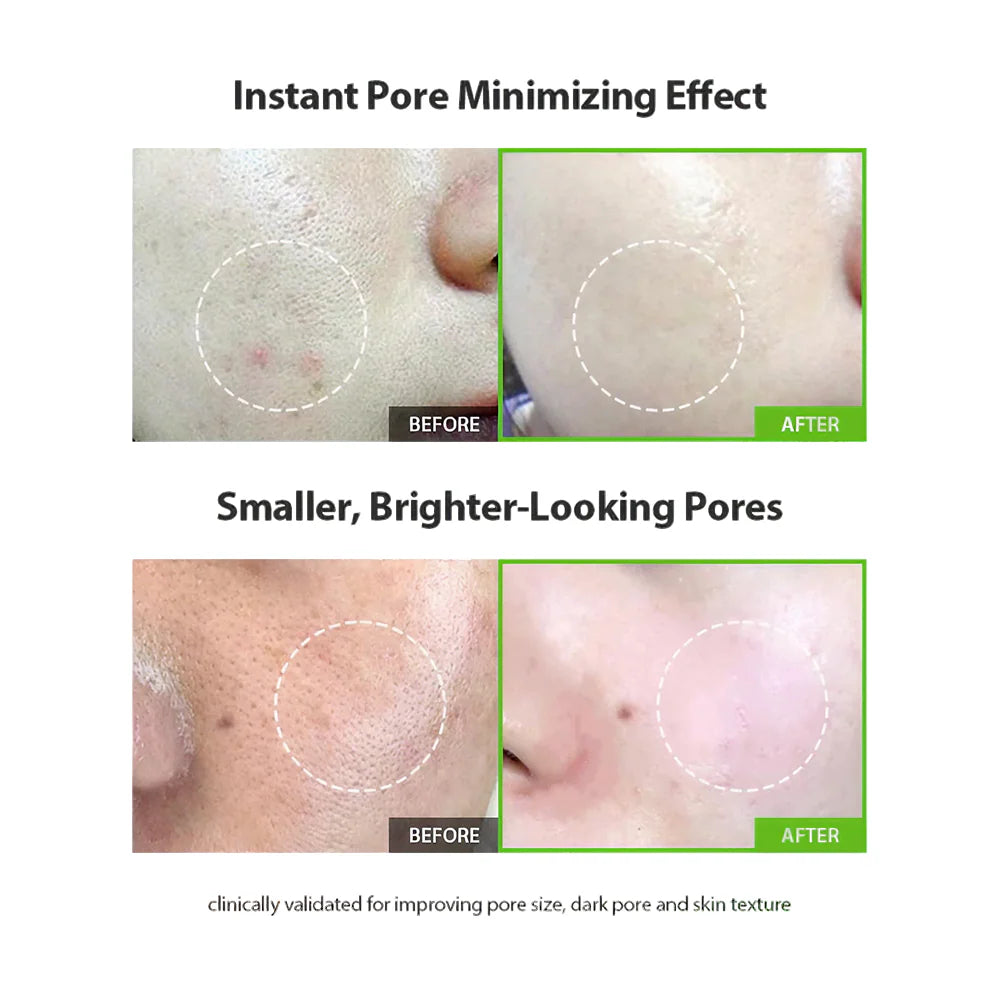 ALORÊ GREEN TOMATO PORE LIFTING AMPOULE — CLARITY & FIRMNESS IN ONE DROP